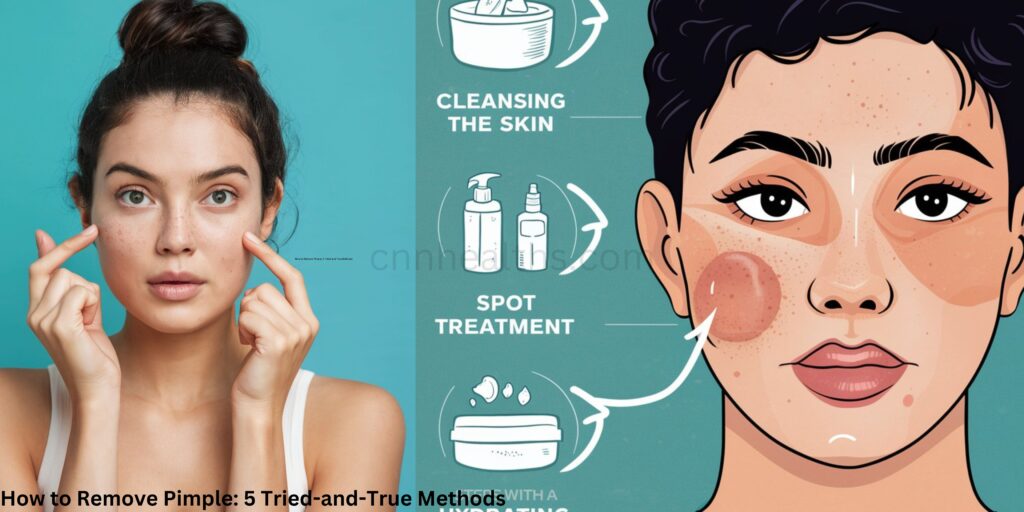 How to Remove Pimple: 5 Tried-and-True Methods