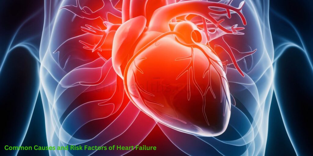 Common Causes and Risk Factors of Heart Failure